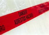 Asbestos Exposure could have Asthma Symptoms