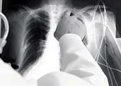 Exposure to Asbestos Growing Concern